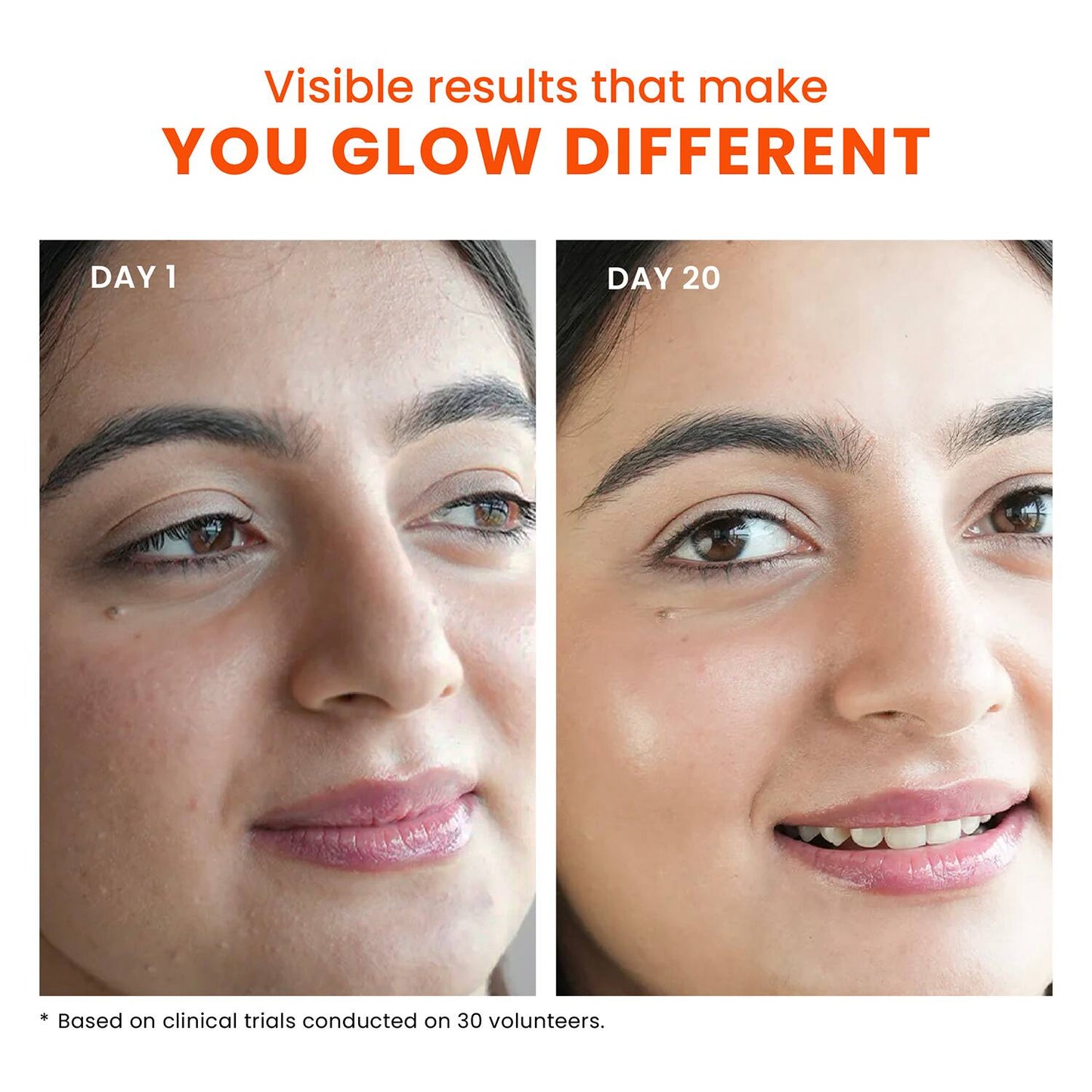 Foxtale The Dazzler Multivitamin Glow Toner + Makeup Setting Spray (150 ml)